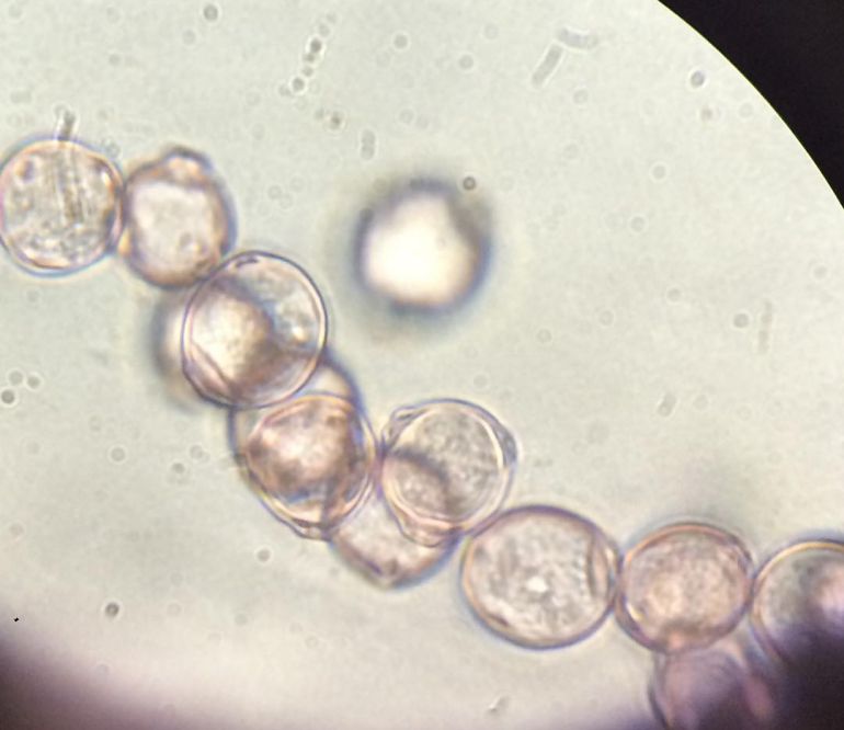 pollen of birch tree under a microscope